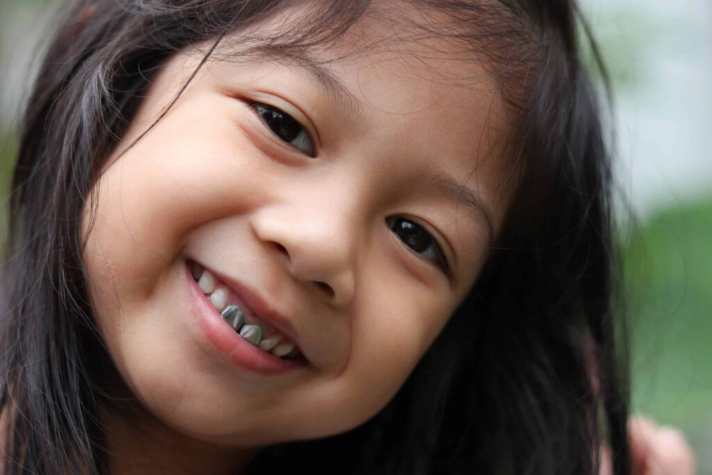Dental Crowns