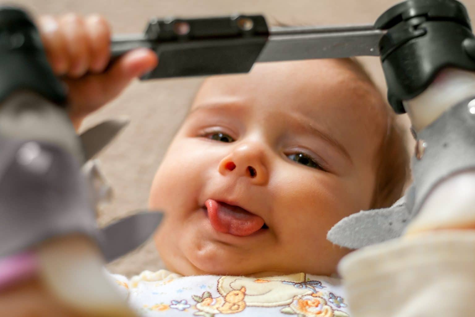 tongue tie what it is and how its treated