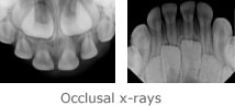 dental x rays in brighton