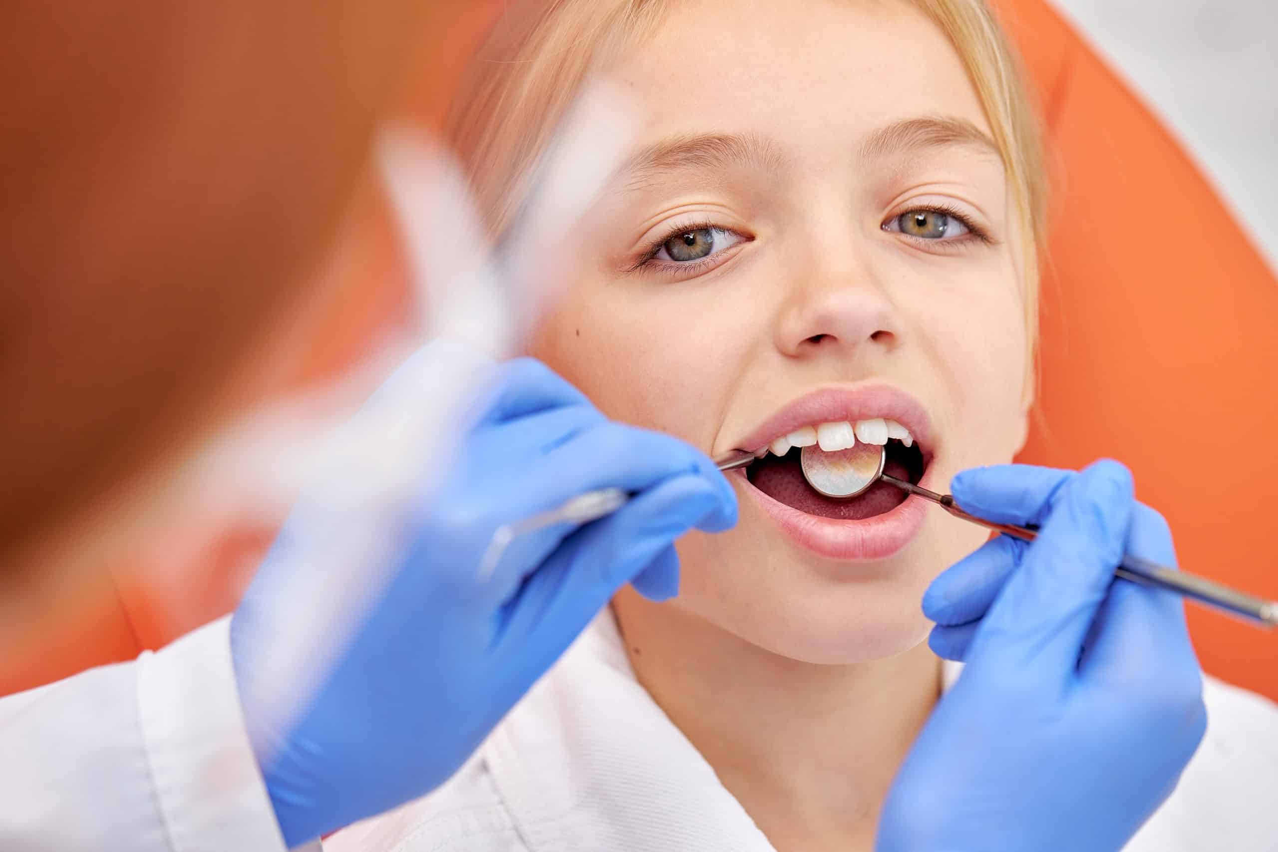 Benefits of Dental Sealants for Children’s Oral Health - Kids City Dental